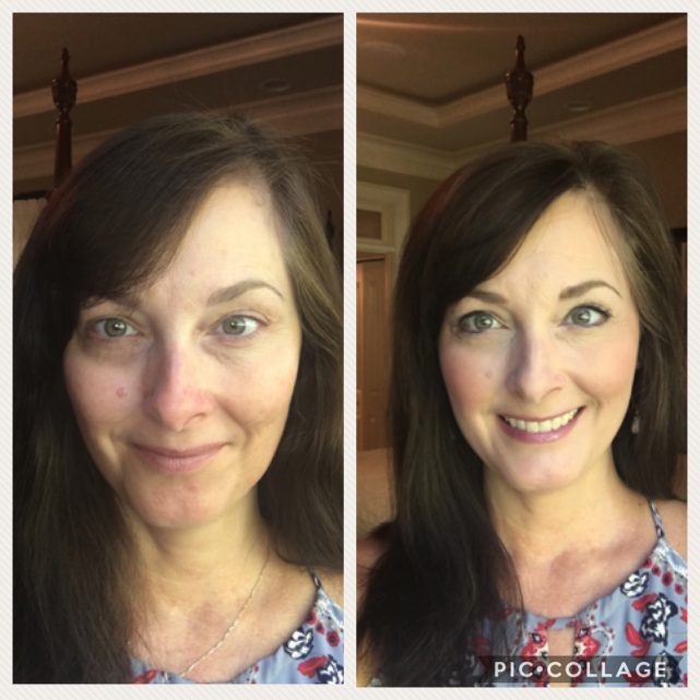 Limelight by Alcone professional quality makeup is the only thing that conceals my dark circles and discoloration. Miracle worker!